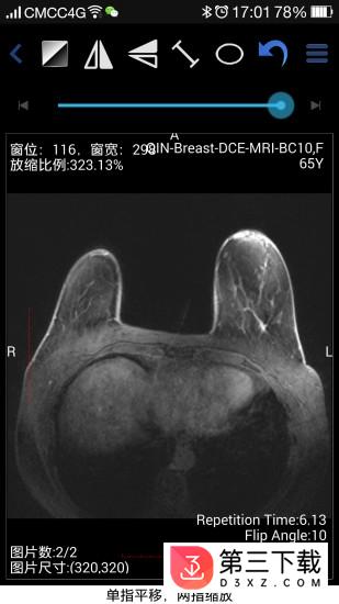 医影在线客户端下载